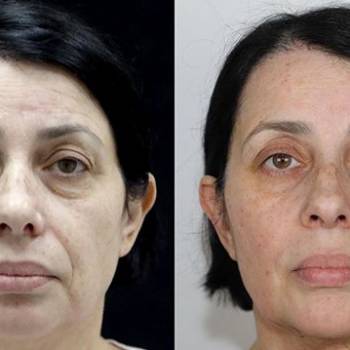 Фото с портфолио Андрей Харьков 