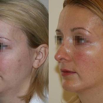 Фото с портфолио Андрей Харьков 