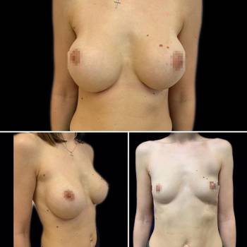 Игорь Зверев , Киев Фото - 5