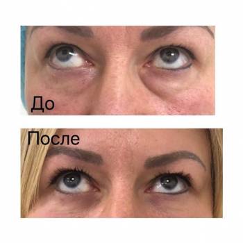 Сергей Гришай , Киев Фото - 5