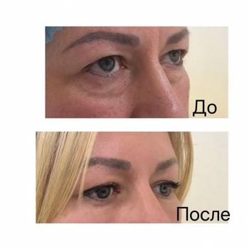 Сергей Гришай , Киев Фото - 6