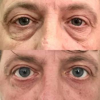 Фото с портфолио Тарас Врублевский 