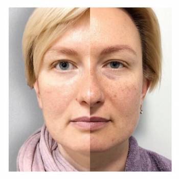 Варсик Дадаян , Киев Фото - 5