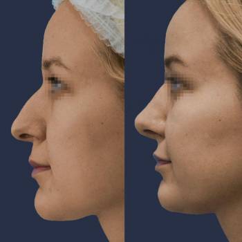 Павел Андреевич Денищук , Киев Фото - 5