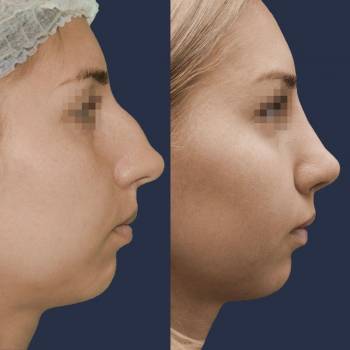 Павел Андреевич Денищук , Киев Фото - 6