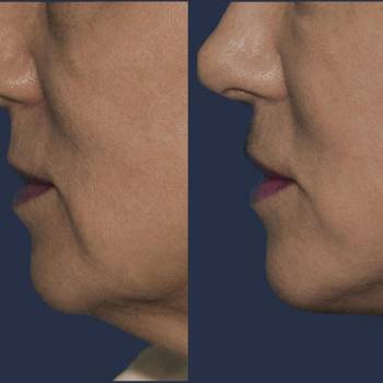 Павел Андреевич Денищук , Киев Фото - 7