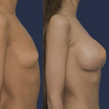 Павел Андреевич Денищук , Киев Фото - 9