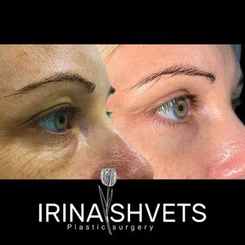 Фото с портфолио Ирина Швец 