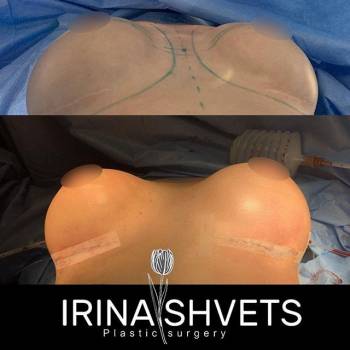 Фото с портфолио Ирина Швец 