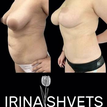 Фото с портфолио Ирина Швец 