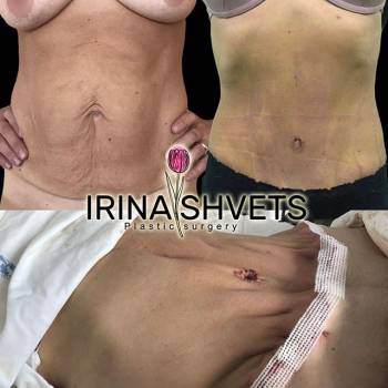 Фото с портфолио Ирина Швец 