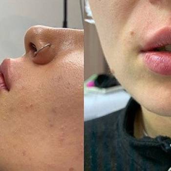 Фото с портфолио Андрей Яковенко 