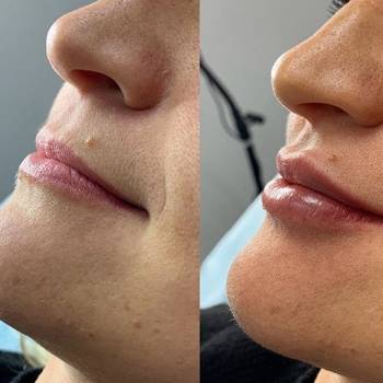 Фото с портфолио Андрей Яковенко 