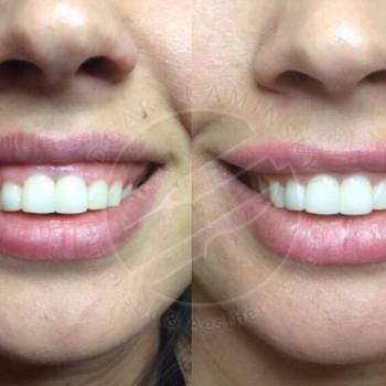 Фото с портфолио Эдгар Каминский 