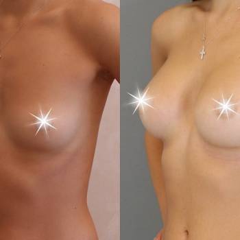 Евгений Донец , Київ Фото - 5