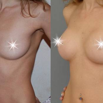 Евгений Донец , Київ Фото - 7