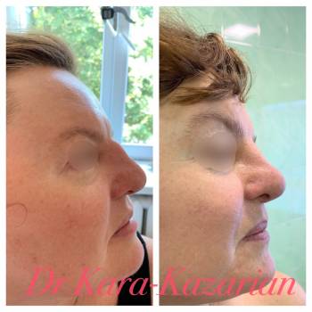 Армине Кара-Казарян , Киев Фото - 6