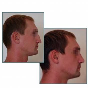 Фото с портфолио Андрей Петах 