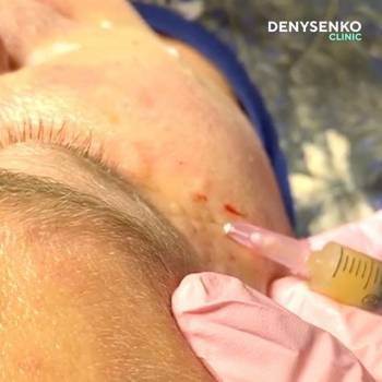 Роман Денисенко , Киев Фото - 8