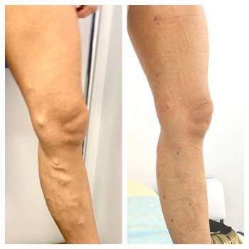 Геннадий Бука , Киев Фото - 5