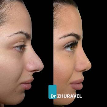 Олексій Журавель, Київ Фото - 5