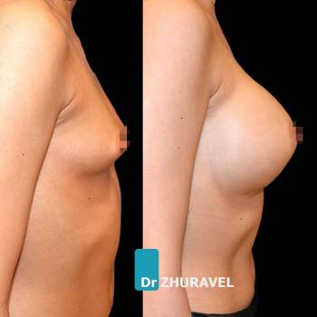 Олексій Журавель, Київ Фото - 6