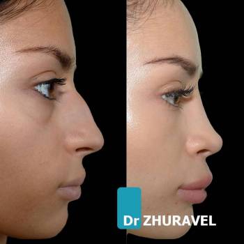 Олексій Журавель, Київ Фото - 7