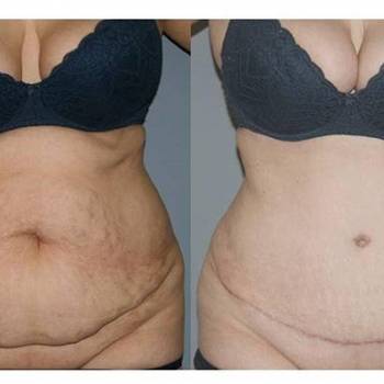 Вадим Симонов , Київ Фото - 6