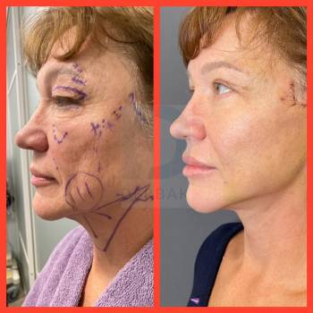 Сергей Дербак, Київ Фото - 5