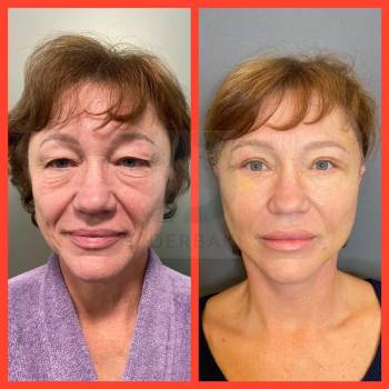 Сергей Дербак, Київ Фото - 6