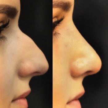 Фото с портфолио Евгений Рукин 