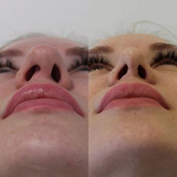 Евгений Логвинов , Київ Фото - 7