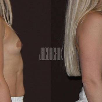 Андрей Якобчук , Киев Фото - 5