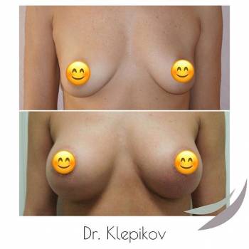 Сергей Клепиков , Харків Фото - 6