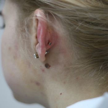 Пирсинг
                    Тату салон Black Ink Tattoo Studio Чернігів