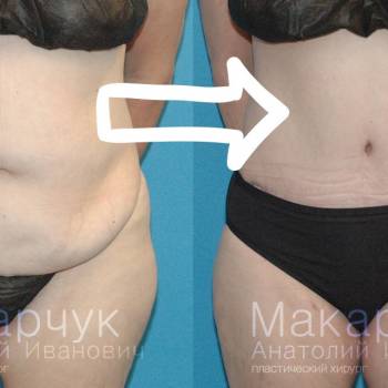 Анатолий Макарчук , Днепр Фото - 5