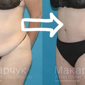 Анатолий Макарчук , Днепр Фото - 6