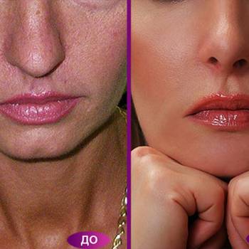 Дмитрий Спариш , Днепр Фото - 5