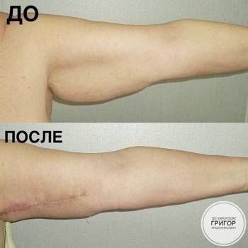 Григор Тер-Никогосян , Николаев Фото - 5