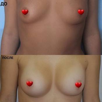 Григор Тер-Никогосян , Николаев Фото - 6