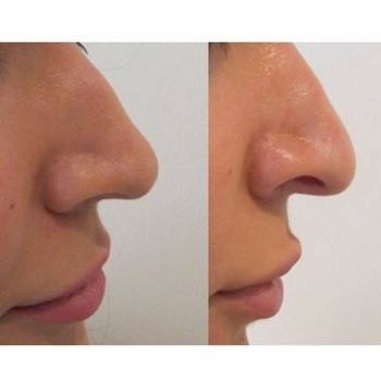 Фото с портфолио Сет Касикович Казарян 