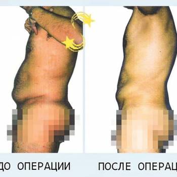 Алексей Сыновец , Одесса Фото - 5