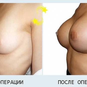 Алексей Сыновец , Одесса Фото - 6