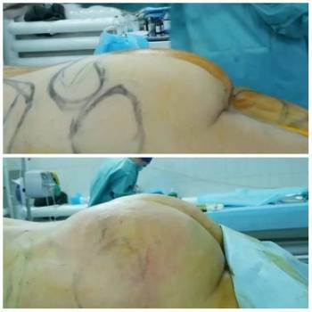 Алексей Сыновец , Одесса Фото - 7