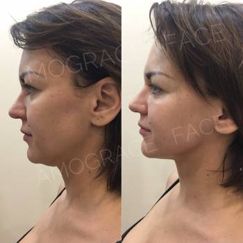 Amograce, Киев Фото - 5