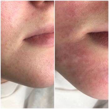 Аліна Ромашова Ромашова, Львов Фото - 7