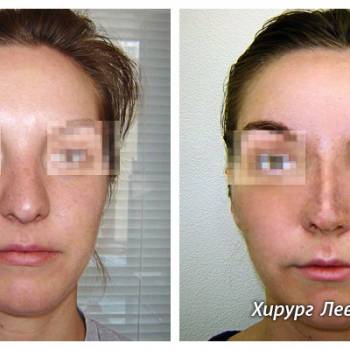 Фото с портфолио Киевский областной центр пластической хирургии