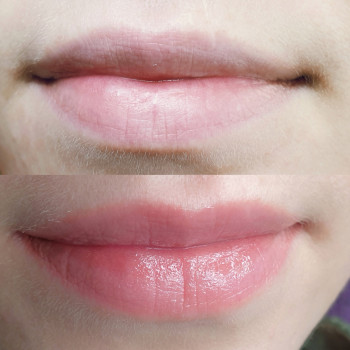 Перманентный макияж губ, камуфлирование шрама