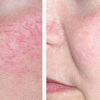 Работа с курерозом