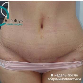 Оливия, Запоріжжя Фото - 5